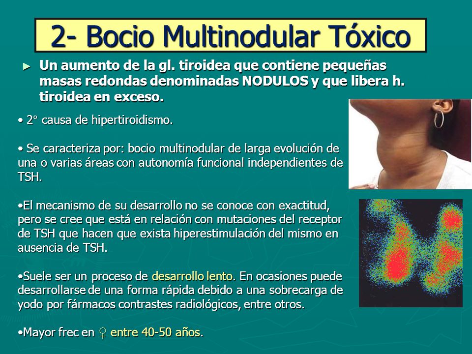 BOCIO MULTINODULAR TOXICO PDF BOCIO MULTINODULAR TOXICO PDF